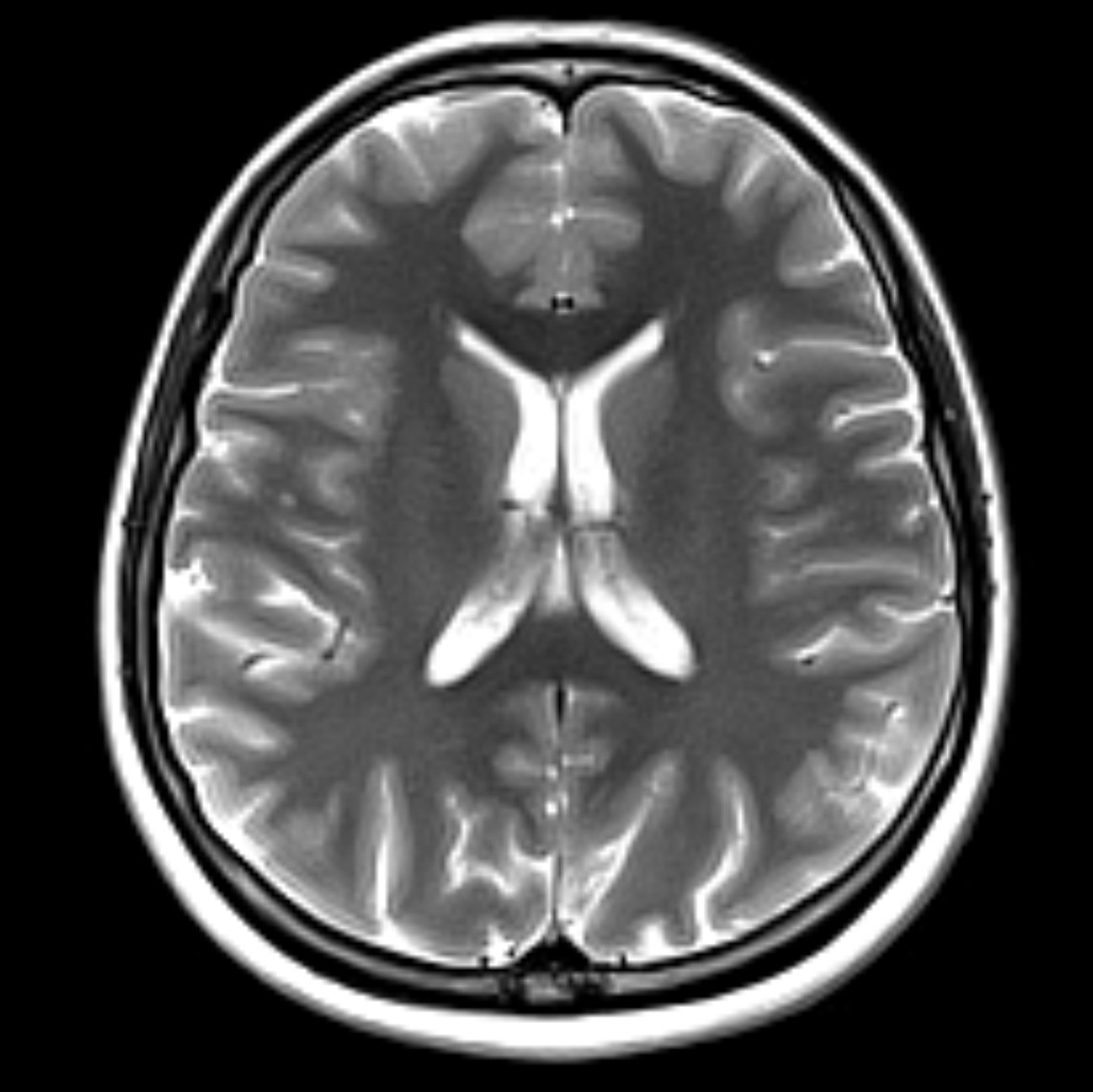 MRT Kopf | Röntgenpraxis im Tesdorpfhaus